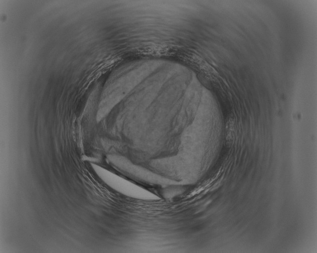 X0000087361202200705181143