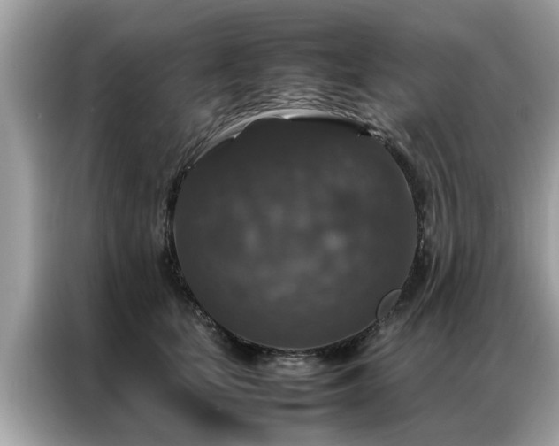 X0000087370659200704271456
