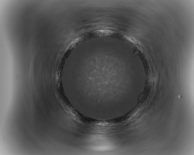 X0000087370759200704271455