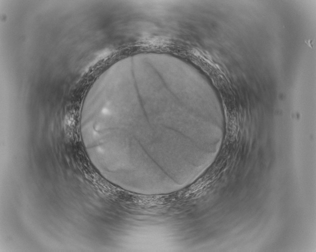 X0000087371254200705111701