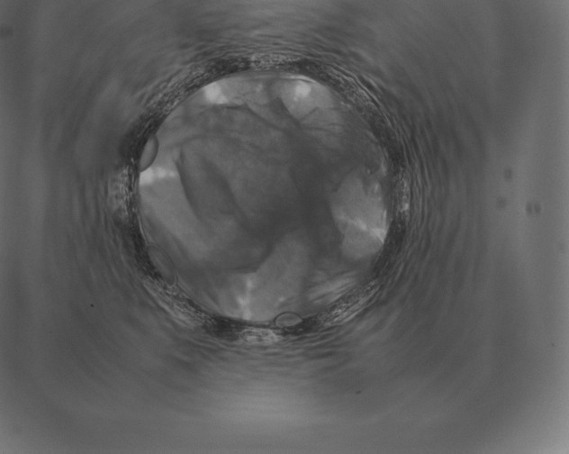 X0000087370519200705181220