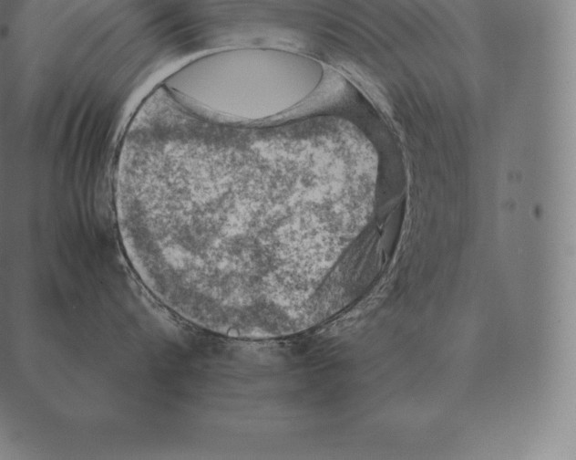 X0000087370816200705181215