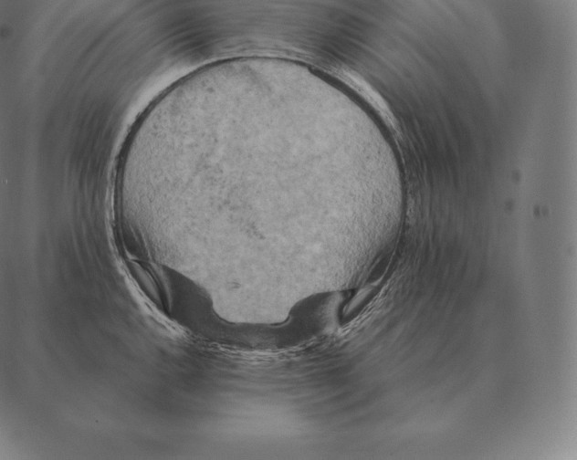 X0000087371144200705181210