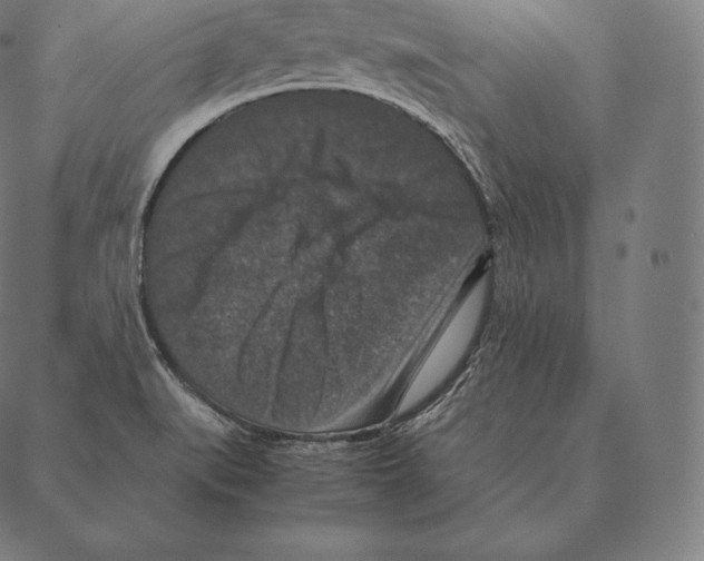 X0000087371519200705181204