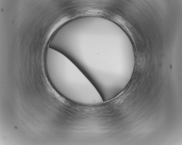 X0000087381235200704200835