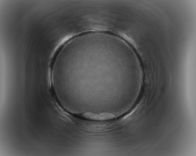 X0000087381171200704201240