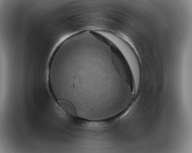 X0000087381179200704201240