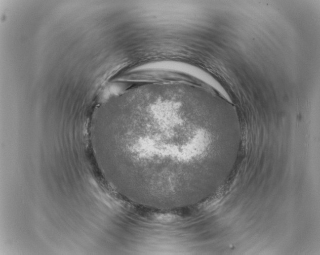 X0000087380360200705041951