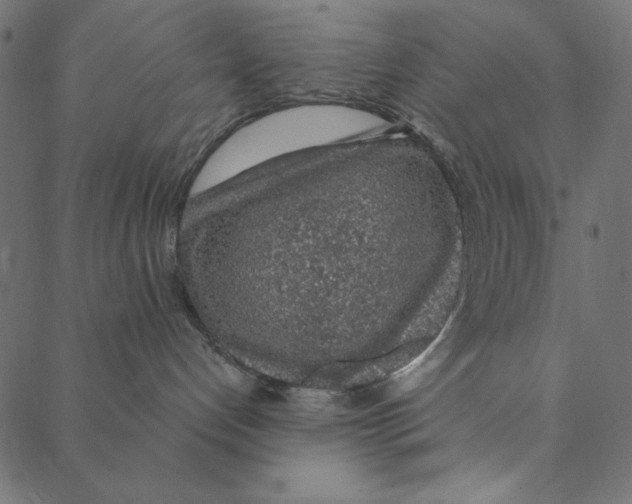 X0000087380192200705181251