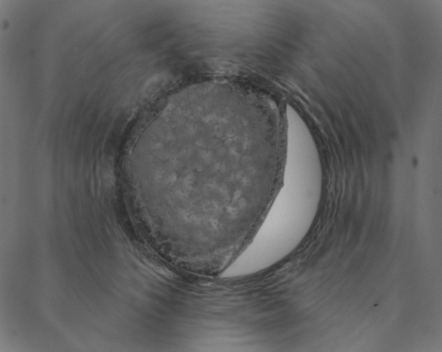 X0000087380516200705181245