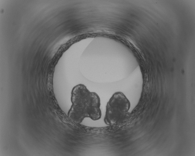 X0000087381016200705181237