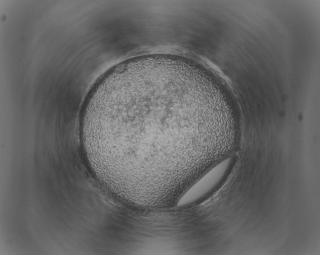 X0000087381174200705181235