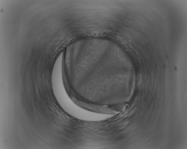 X0000087381202200705181233