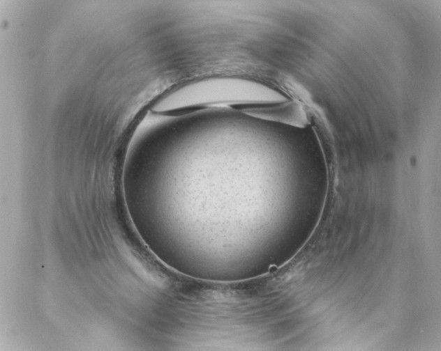 X0000087390250200705042017