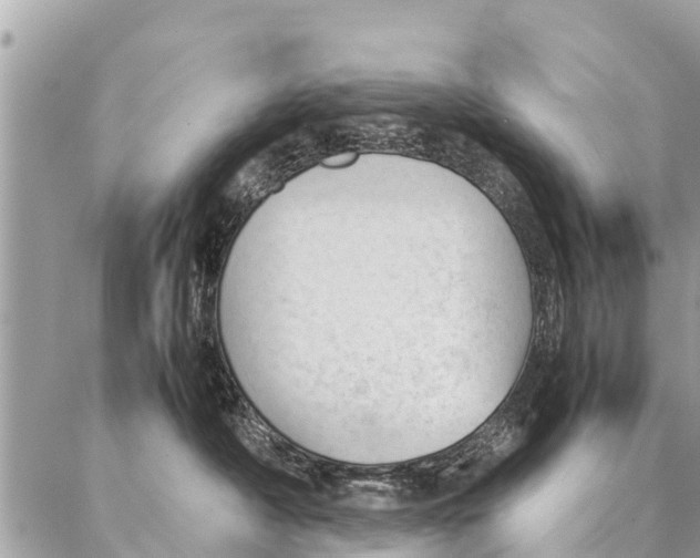 X0000087390430200705042015