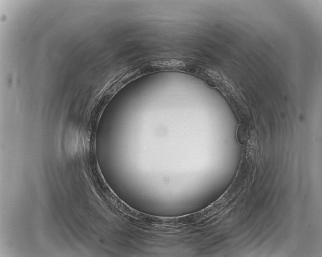 X0000087400739200704200952
