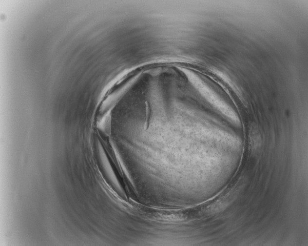 X0000087401460200705042023