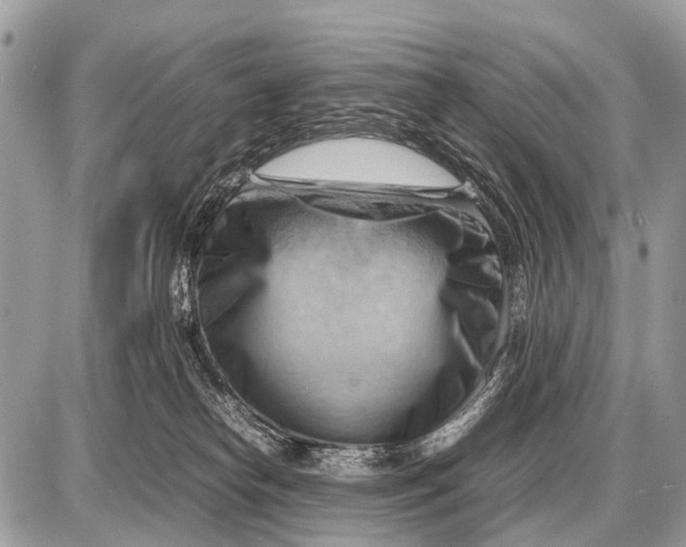 X0000087400182200705111835