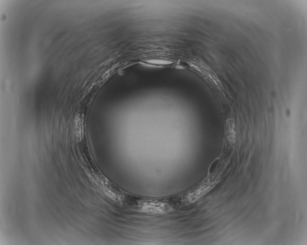 X0000087400471200705111830