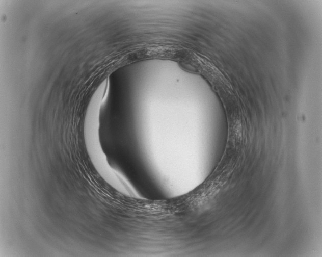 X0000087400914200705111822