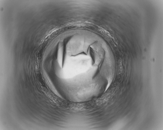 X0000087401158200705111818