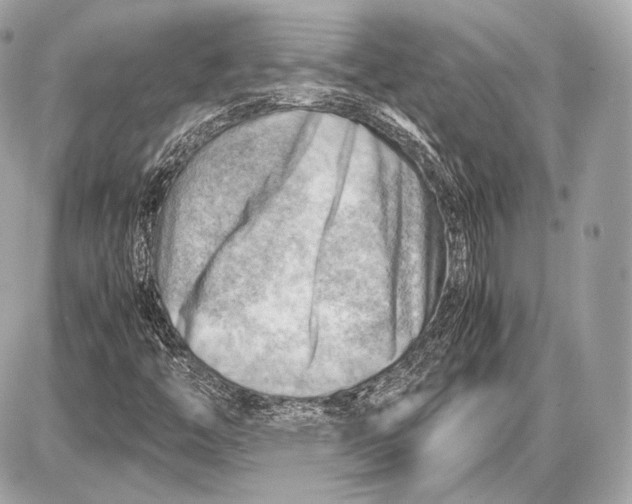 X0000087401446200705111814