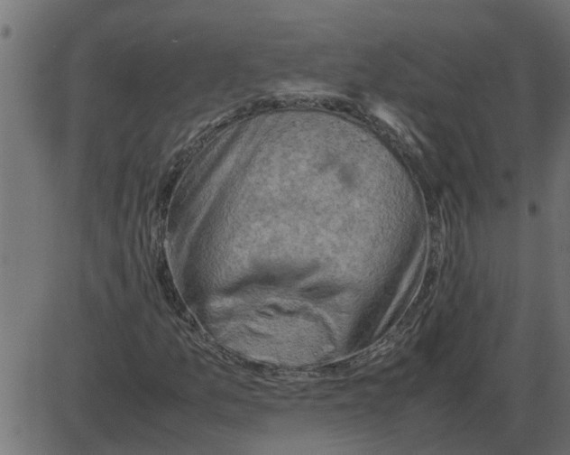 X0000087401157200705181325