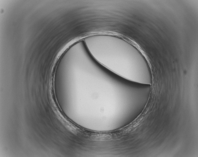 X0000087411187200704201013