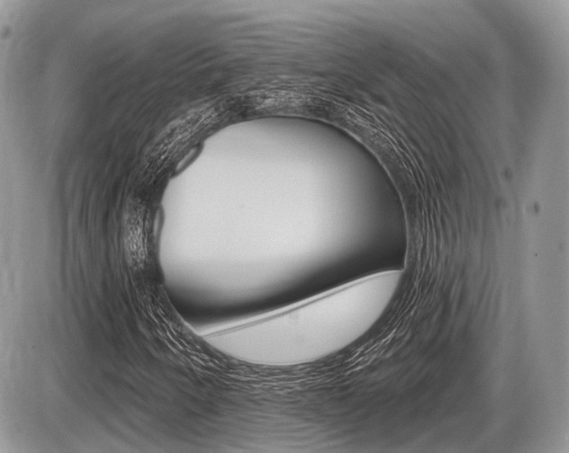 X0000087411250200704201012