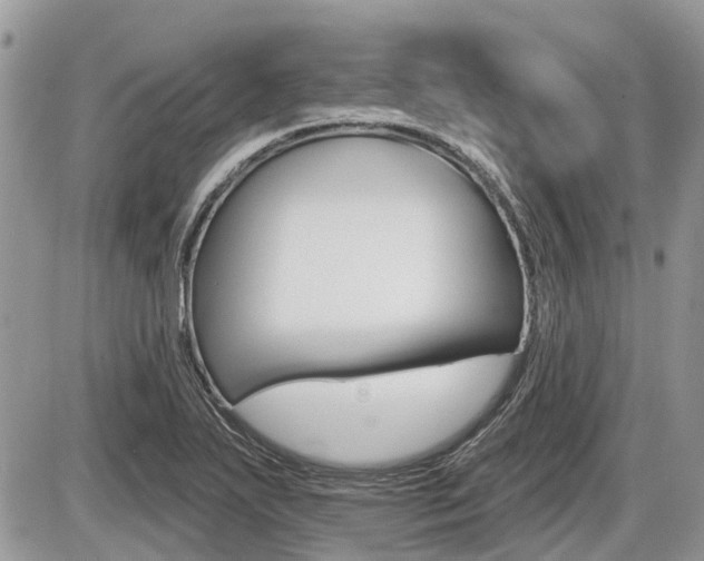 X0000087411271200704201011