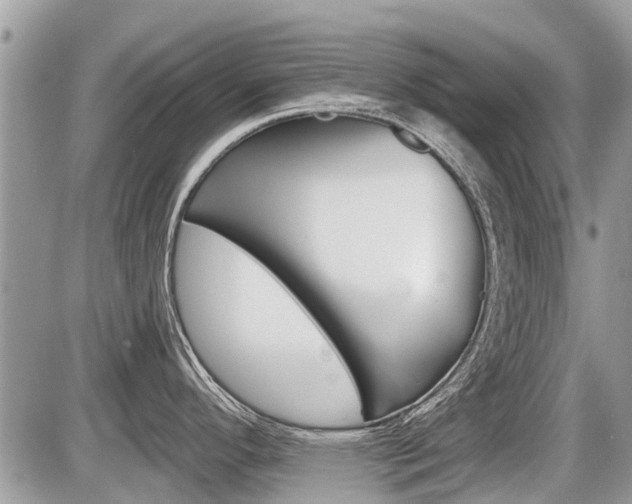 X0000087411296200704201011