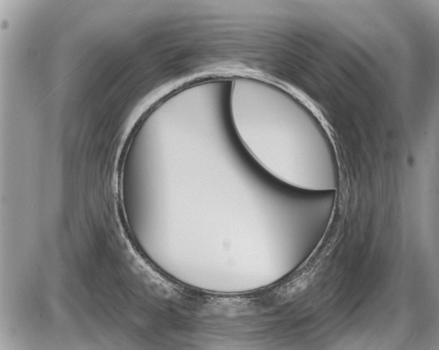 X0000087411335200704201011