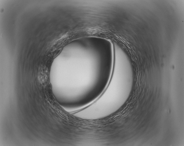 X0000087411349200704201010