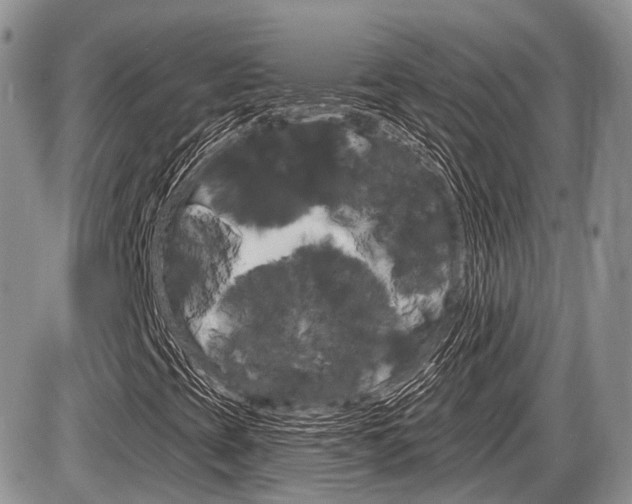 X0000087411393200704201008