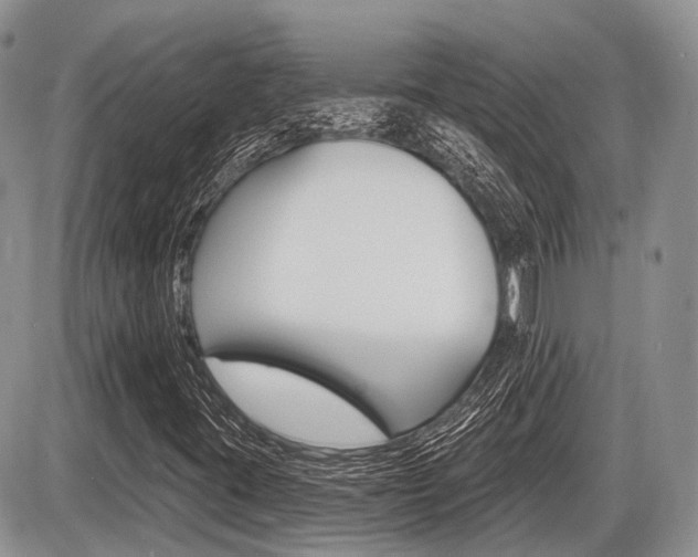 X0000087411395200704201009