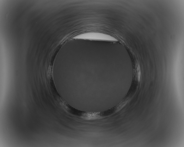 X0000087410093200705041256