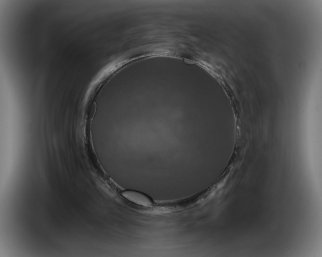 X0000087410149200705041255