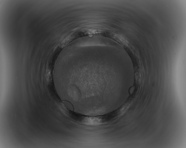 X0000087410327200705041253