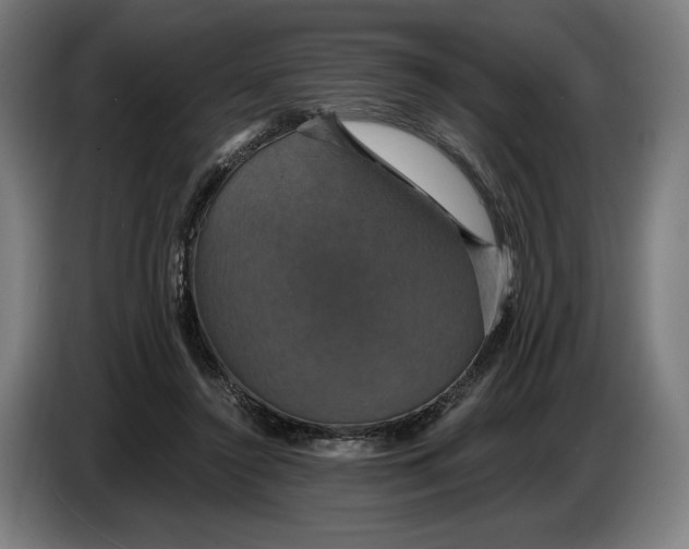 X0000087410356200705041252