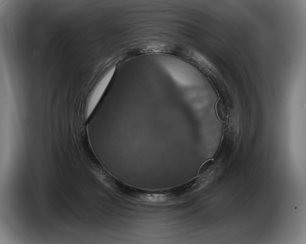 X0000087410361200705041252