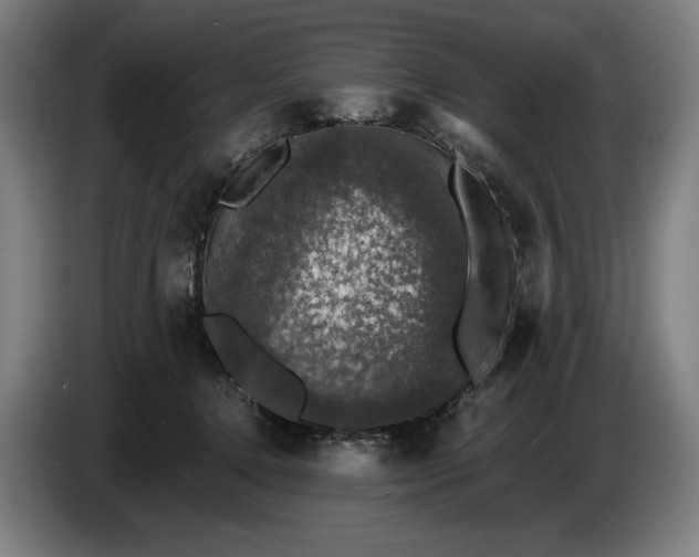 X0000087410368200705041252