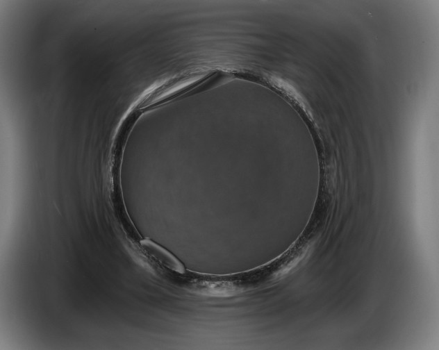 X0000087410395200705041252