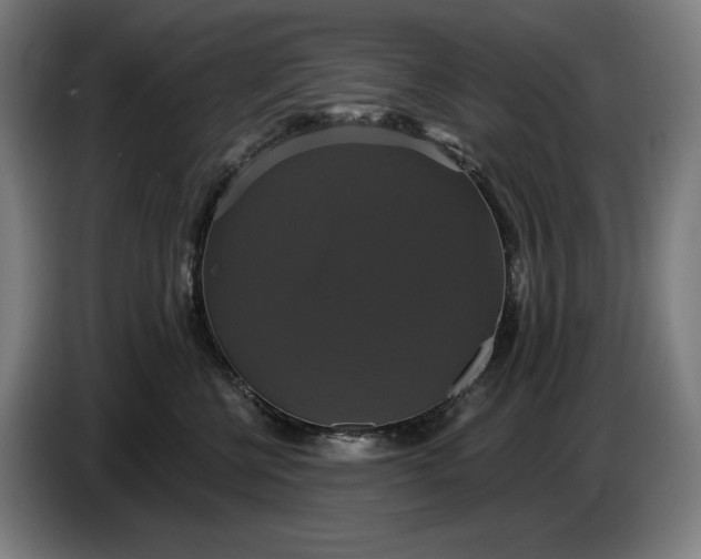 X0000087410570200705041250