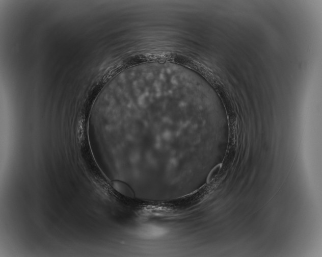 X0000087410699200705041248