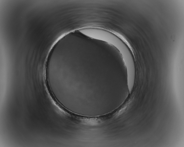 X0000087410999200705041244