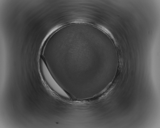 X0000087411138200705041243