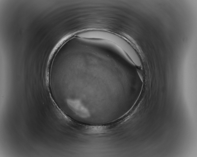 X0000087411188200705041242
