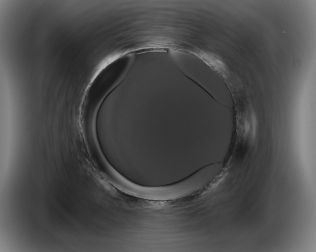 X0000087411230200705041241