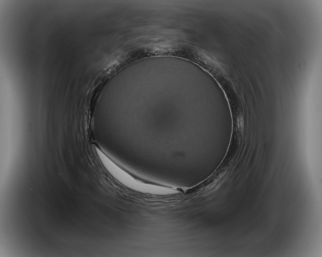X0000087411300200705041240