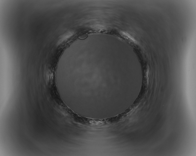 X0000087411302200705041240